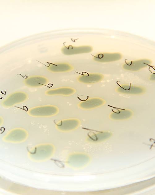 A plate of Chlamydomonas reinhardtii colonies that are the result of a genetic cross